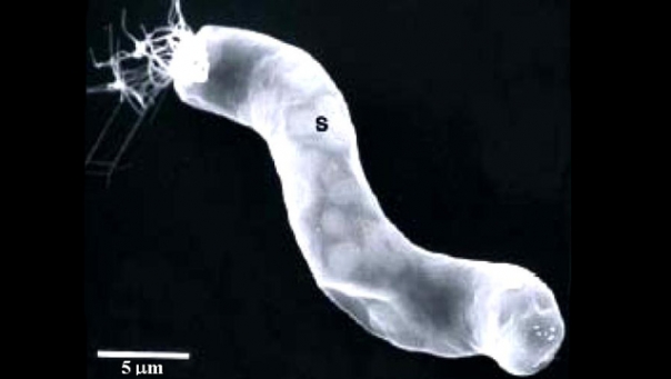 Bacteria in Meteorites Aliens Journal of Cosmology